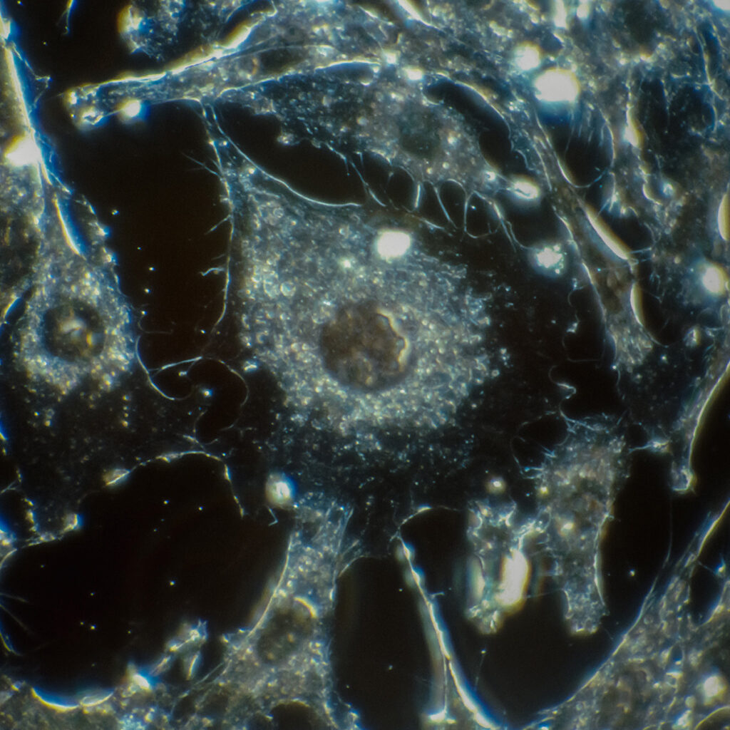 Bild einer Krebszelle